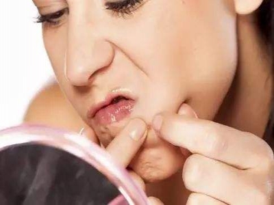 痤疮毁颜值，为你献良方，赶紧收藏！