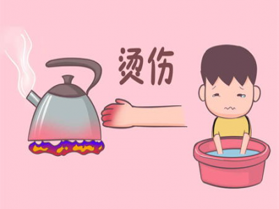 光神巴德尔：不小心烫伤、烧伤，怎样处理恢复快、不留疤！