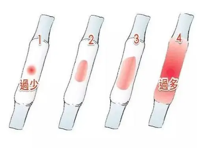 光神巴德尔：大姨妈两天就没了？“月经量少”最可怕的是什么？