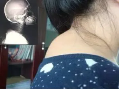 这个部位一旦凸起，寿命开始倒计时！