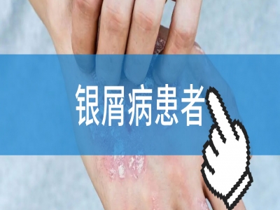 健康指南：银屑病光疗研究新发现，照亮治疗之路
