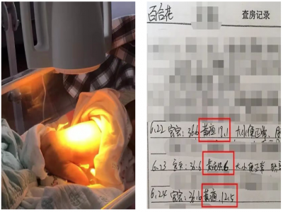 【科技育儿】从发现到治愈：光疗法解决新生儿黄疸的医学探索与进展
